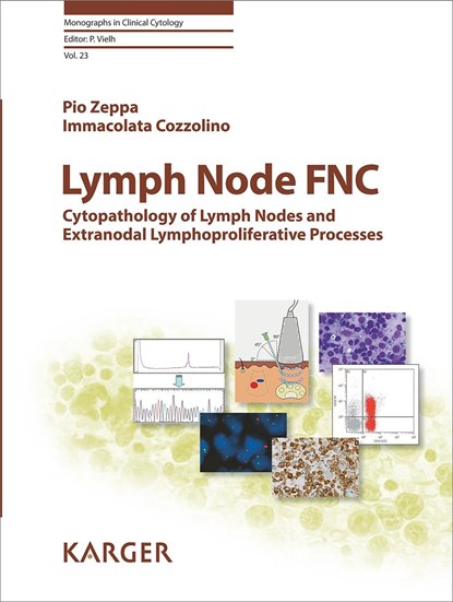 Lymph Node FNC, niet bekend - Gebonden - 9783318061147