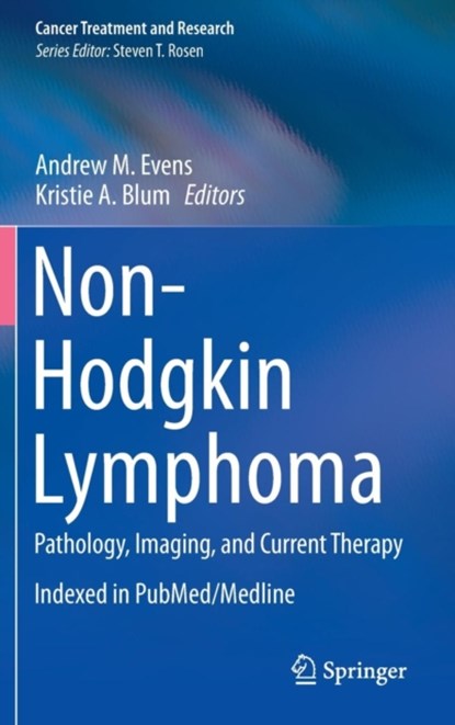 Non-Hodgkin Lymphoma, niet bekend - Gebonden - 9783319131498