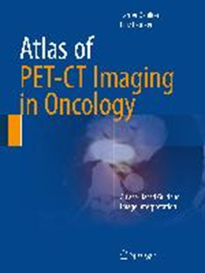 Atlas of PET-CT Imaging in Oncology, OEZULKER,  Tamer ; OEzulker, Filiz - Gebonden - 9783319189932