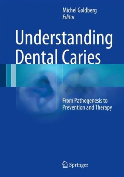 Understanding Dental Caries, niet bekend - Gebonden - 9783319305509