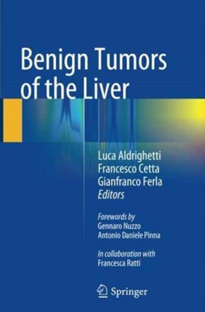 Benign Tumors of the Liver, niet bekend - Paperback - 9783319346731