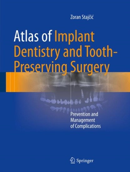 Atlas of Implant Dentistry and Tooth-Preserving Surgery, Zoran Stajcic - Gebonden - 9783319421223