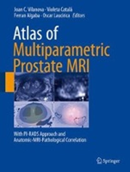 Atlas of Multiparametric Prostate MRI, VILANOVA,  Joan C. ; Catala, Violeta ; Algaba, Ferran - Gebonden - 9783319617855