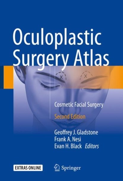 Oculoplastic Surgery Atlas, niet bekend - Gebonden - 9783319673301