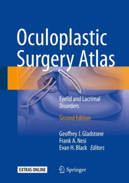 Oculoplastic Surgery Atlas, niet bekend - Gebonden - 9783319673332