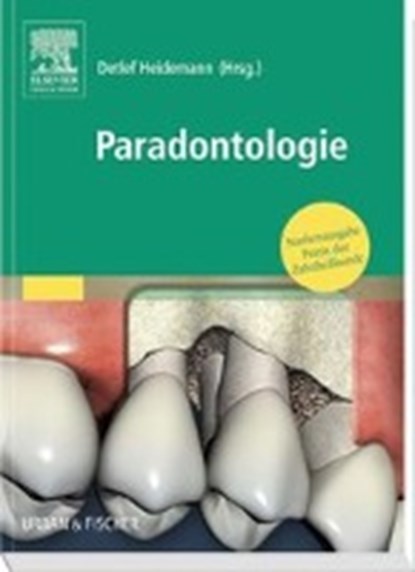 Praxis der Zahnheilkunde 4 Parodontologie, niet bekend - Paperback - 9783437313189