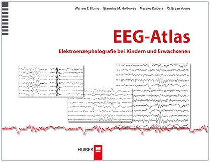 EEG-Atlas, Warren T. Blume ;  Giannina M. Holloway ;  Masako Kaibara ;  G. Bryan Young - Gebonden - 9783456852645