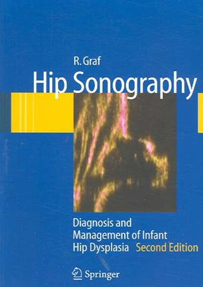 Hip Sonography, R. Graf - Paperback - 9783540309574