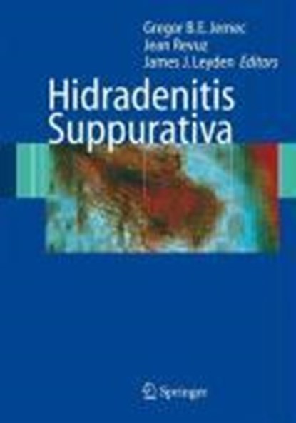 Hidradenitis Suppurativa, Gregor Jemec ; Jean Revuz ; James J. Leyden - Gebonden - 9783540331001