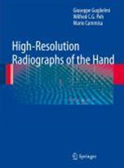 High-Resolution Radiographs of the Hand, Giuseppe Guglielmi ; Wilfred C. G. Peh ; Mario Cammisa - Gebonden - 9783540794790