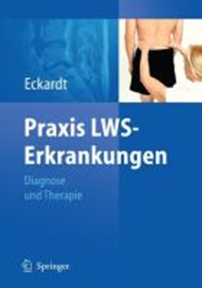 Praxis LWS-Erkrankungen, Anke Eckardt - Gebonden - 9783540885054