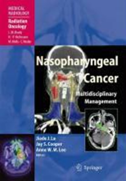 Nasopharyngeal Cancer, Jiade J. Lu ; Jay S. Cooper ; Anne W. M. Lee - Gebonden - 9783540928096