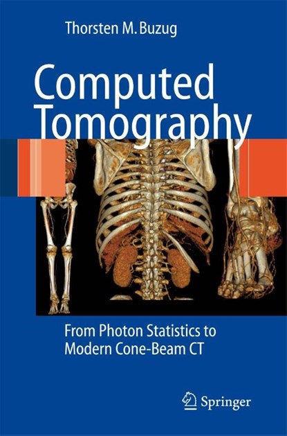 Computed Tomography, Thorsten M. Buzug - Paperback - 9783642072574