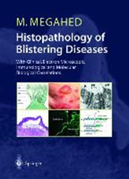 Histopathology of Blistering Diseases, Mosaad Megahed - Paperback - 9783642622236