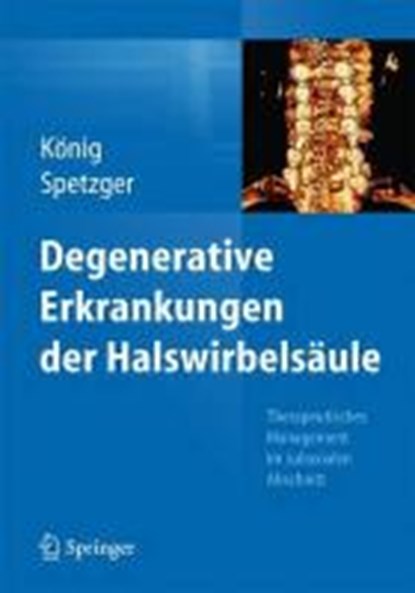 Degenerative Erkrankungen Der Halswirbelsaule, Stefan Alexander Koenig ; Uwe Spetzger - Gebonden - 9783662435618
