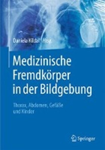Medizinische Fremdkorper in der Bildgebung, Daniela Kildal - Gebonden - 9783662472958