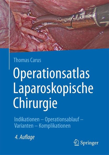 Operationsatlas Laparoskopische Chirurgie, Thomas Carus - Gebonden - 9783662582381