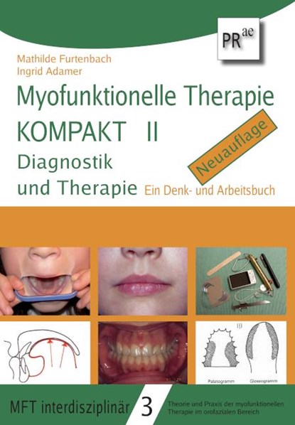 Myofunktionelle Therapie KOMPAKT II, Mathilde Furtenbach ; Ingrid Adamer - Paperback - 9783706912556