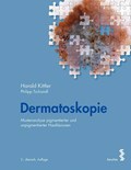 Dermatoskopie | Kittler, Harald ; Tschandl, Philipp | 