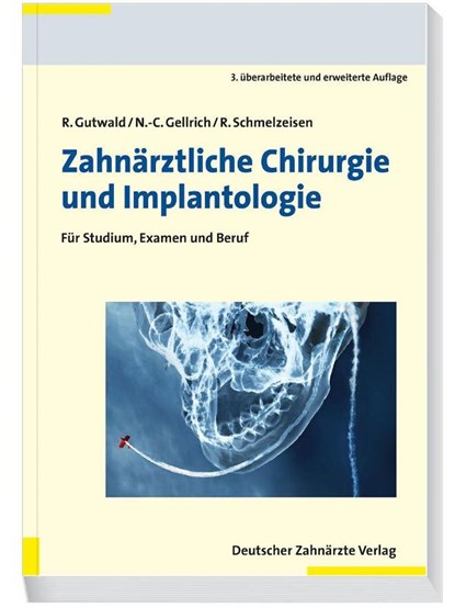 Zahnärztliche Chirurgie und Implantologie, Ralf Gutwald ; N. -C. Gellrich ; Rainer Schmelzeisen - Paperback - 9783769136579