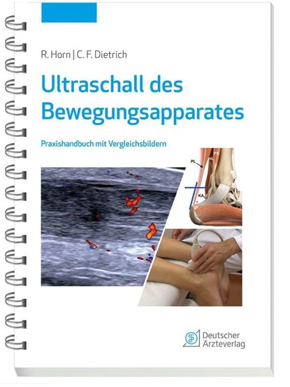 Ultraschall des Bewegungsapparates, Rudolf Horn ; Christoph F. Dietrich - Paperback - 9783769137668