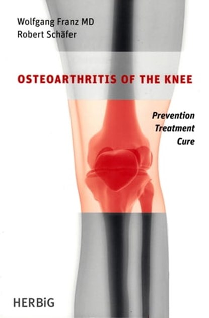 Osteoarthritis of the knee, Wolfgang Franz ; Robert Schäfer - Ebook - 9783776681901