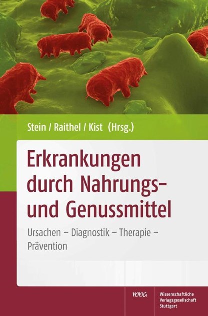 Erkrankungen durch Nahrungs- und Genussmittel, Jürgen Stein ; Martin Raithel ; Manfred Kist - Gebonden - 9783804725652