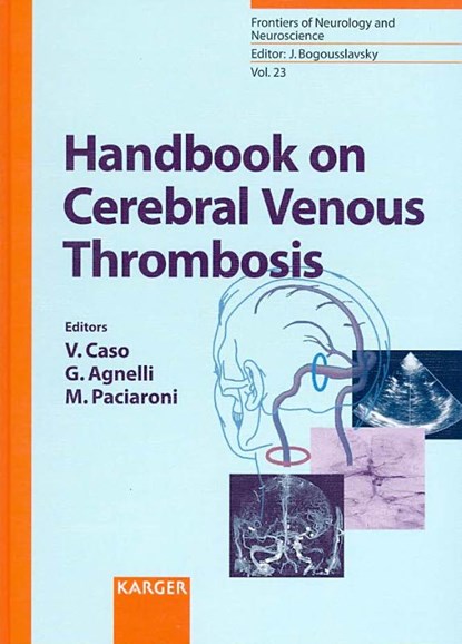 Handbook on Cerebral Venous Thrombosis, CASO,  V. ; Agnelli, G. ; Paciaroni, M. - Gebonden - 9783805583787