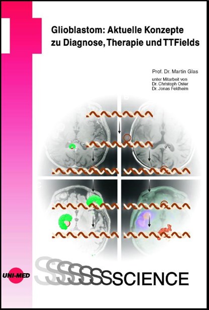 Glioblastom: Aktuelle Konzepte zu Diagnose, Therapie und TTFields, Martin Glas - Gebonden - 9783837416794