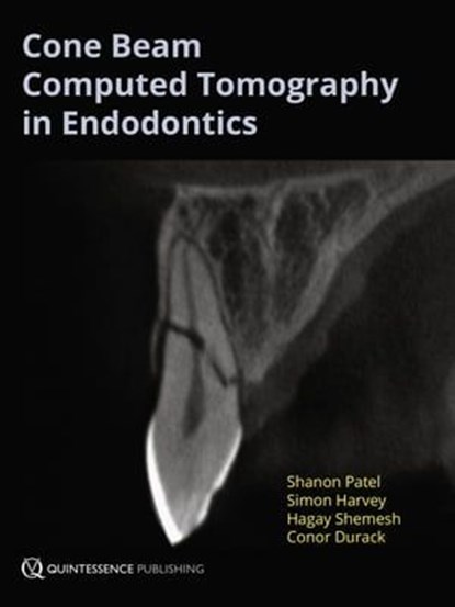 Cone Beam Computed Tomography in Endodontics, Shanon Patel ; Simon Harvey ; Hagay Shemesh ; Conor Durack - Ebook - 9783868673333