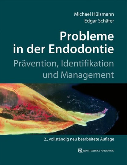 Probleme in der Endodontie, Michael Hülsmann ; Edgar Schäfer - Gebonden - 9783868673661