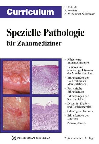 Curriculum Spezielle Pathologie für Zahnmediziner, Harald Ebhardt ; Peter A. Reichart ; Andrea Maria Schmidt-Westhausen - Paperback - 9783868673876