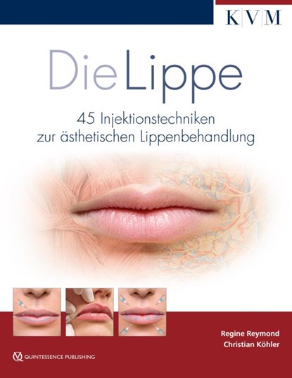 Die Lippe, Regine Reymond ; Christian Köhler - Gebonden - 9783868674026
