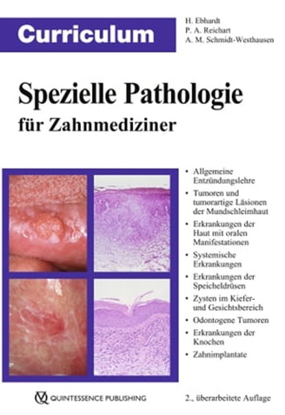 Curriculum Spezielle Pathologie für Zahnmediziner, Harald Ebhardt ; Peter A. Reichart ; Andrea Maria Schmidt-Westhausen - Ebook - 9783868674811