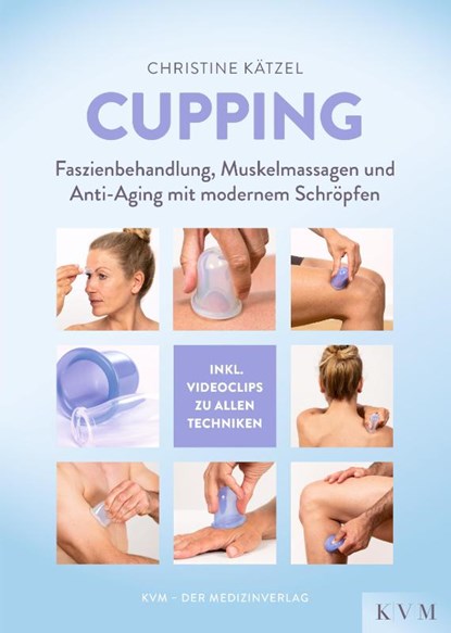 Cupping, Christine Kätzel - Paperback - 9783868674859