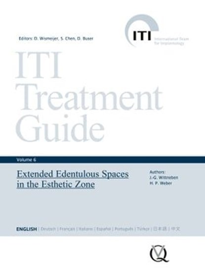 Extended Edentulous Spaces in the Esthetic Zone, Julia-Gabriela Wittneben Matter ; Hans-Peter Weber - Ebook - 9783868674972
