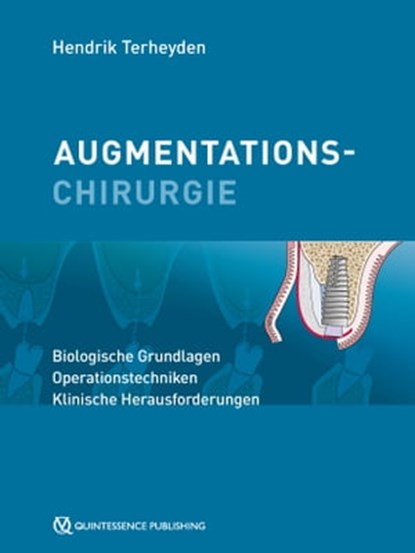 Augmentationschirurgie, Hendrik Terheyden - Ebook - 9783868675542