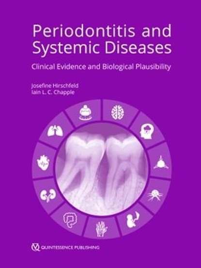 Periodontitis and Systemic Diseases, niet bekend - Ebook - 9783868675573