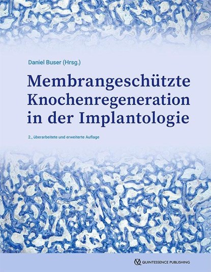 GBR-Technik in der Implantologie, Daniel Buser - Gebonden - 9783868675870