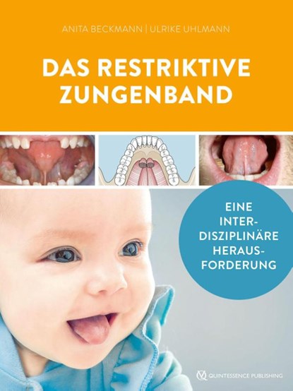 Das restriktive Zungenband, Ulrike Uhlmann ; Anita Beckmann - Gebonden - 9783868676105