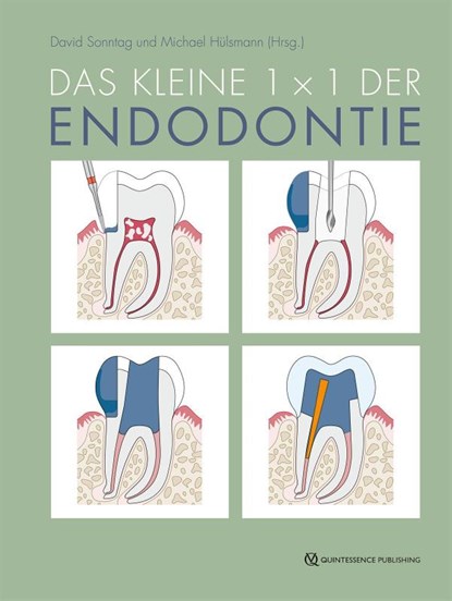 Das kleine 1x1 der Endodontie, David Sonntag ; Michael Hülsmann - Gebonden - 9783868676112