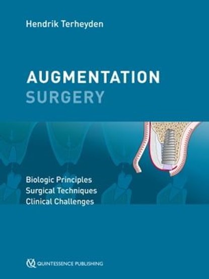 Augmentation Surgery, Hendrik Terheyden - Ebook - 9783868676198