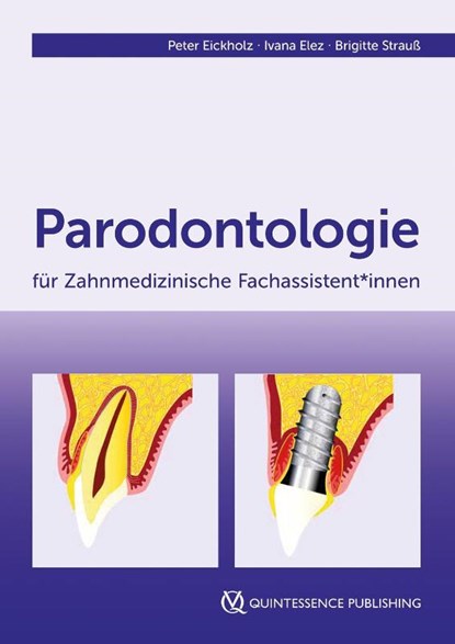 Parodontologie für Zahnmedizinische Fachassistent*innen, Peter Eickholz ; Ivana Elez ; Brigitte Strauß - Paperback - 9783868676242