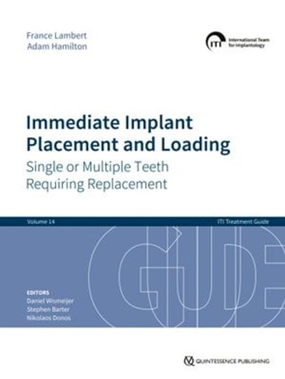 Immediate Implant Placement and Loading – Single or Multiple Teeth Requiring Replacement, France Lambert ; Adam Hamilton - Ebook - 9783868676822