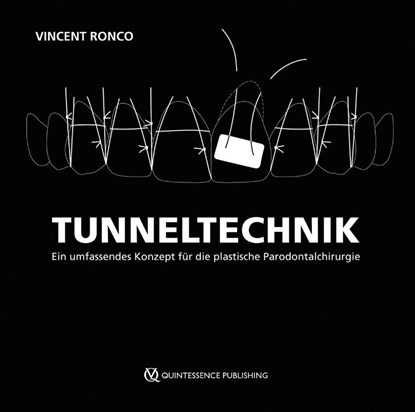 Tunneltechnik, Vincent Ronco - Gebonden - 9783868677188