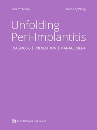 Unfolding Peri-Implantitis, niet bekend - Ebook - 9783868677201