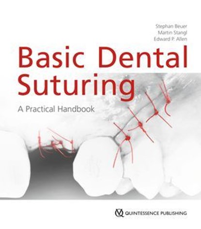 Basic Dental Suturing, Stephan Beuer ; Martin Stangl ; Edward P. Allen - Ebook - 9783868677218