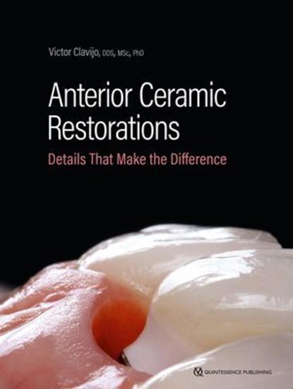 Anterior Ceramic Restorations, Victor Clavijo - Ebook - 9783868677263