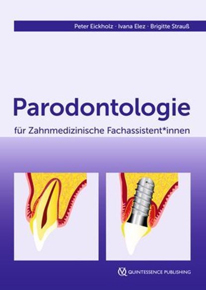 Parodontologie für Zahnmedizinische Fachassistent*innen, Peter Eickholz ; Ivana Elez ; Brigitte Strauß - Ebook - 9783868677270