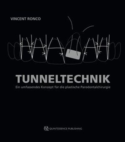 Tunneltechnik, Vincent Ronco - Ebook - 9783868677522